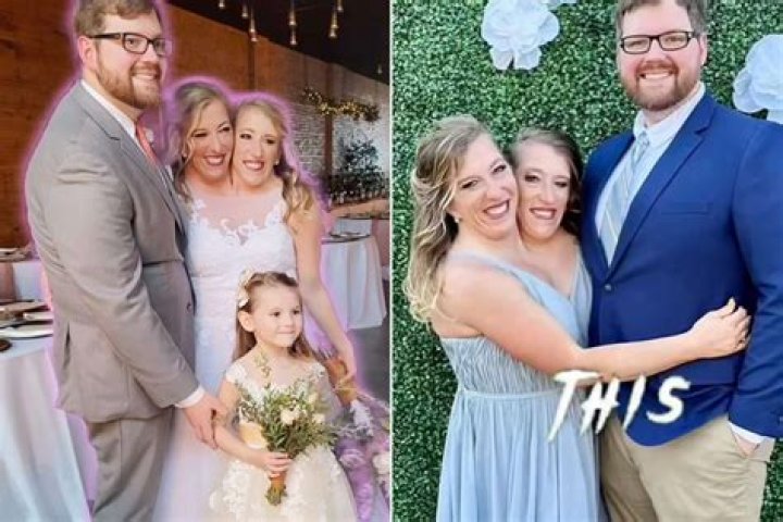 Abby and Brittany Hensel 2019 Married Now? Conjoined Twins Seperated, As Adults, Wedding