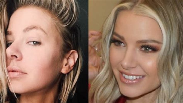 Ariana Madix Nose Job: Before and After Plastic Surgery