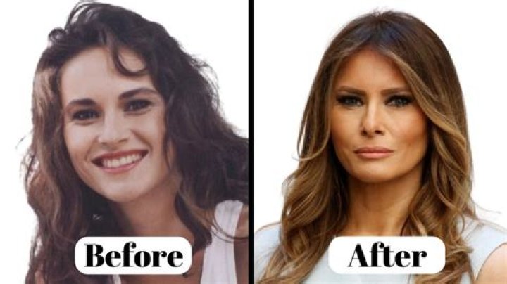 Raquel Welch’s Plastic Surgery: Did The Actress Have Cosmetic Surgery to Look Young? Did She Have Breast Implants?